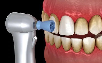 best dental clinic in Surat