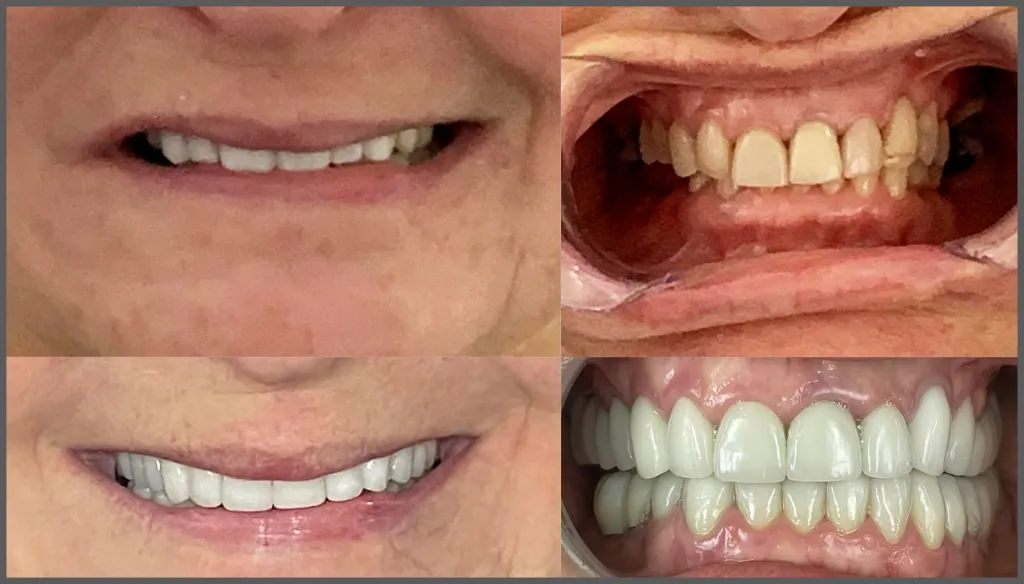 best dental clinic in Surat